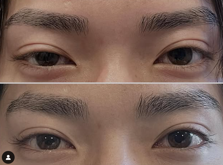 バリー(vary)公式HPキャプチャ