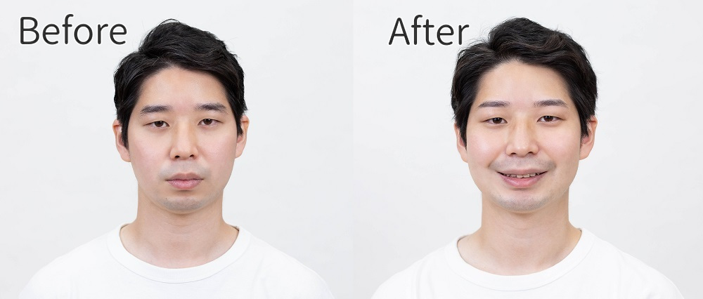FIRSTのBefore・After2